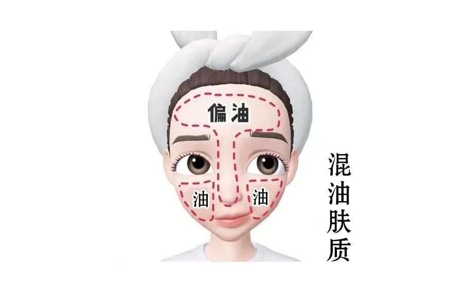 混合性皮膚如何護(hù)理效果好？
