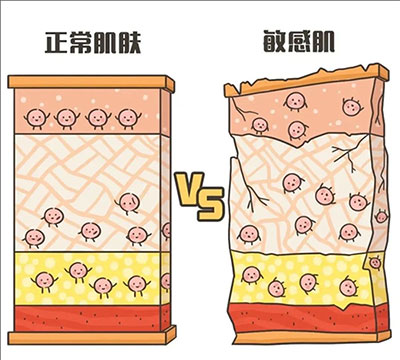 敏感性皮膚產(chǎn)生的原因是什么？